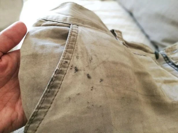 How to Remove Oil Stains From Cotton Pants